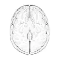 an mri of a brain showing tumor tattoo design idea